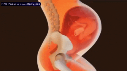 Естественные роды