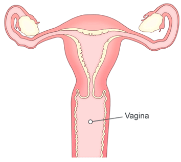 Широкое влагалище