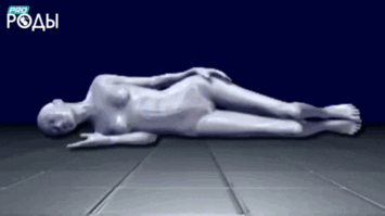 Внематочная беременность - разрыв маточных труб.gif