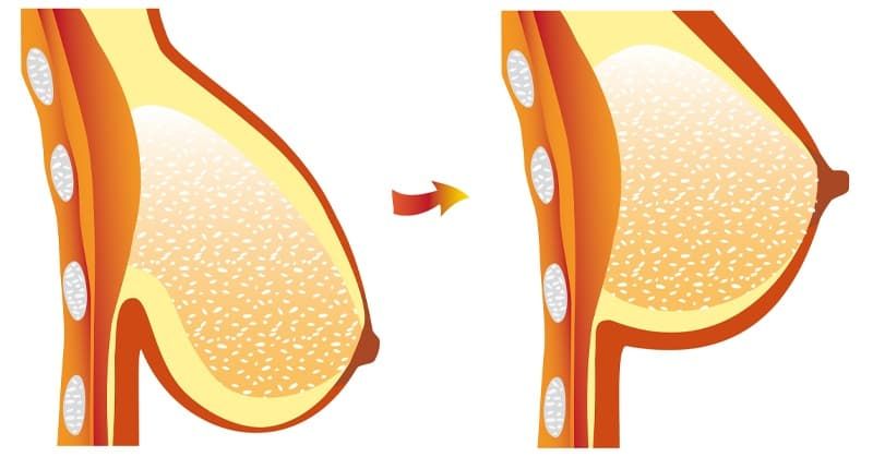 Улучшить тонус кожи и поддержать форму груди