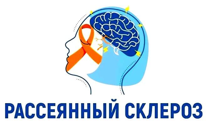 Рассеянный склероз после родов