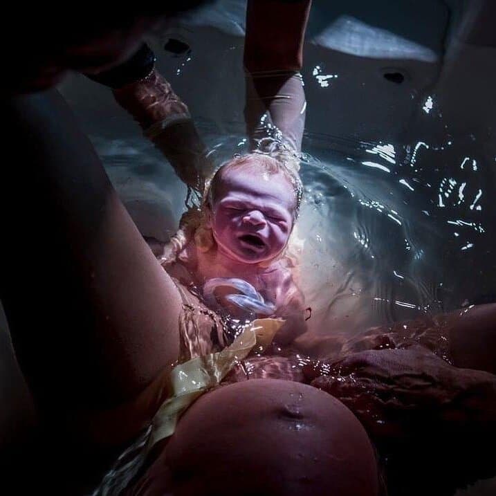 Рождение в воде Рождение в воде
