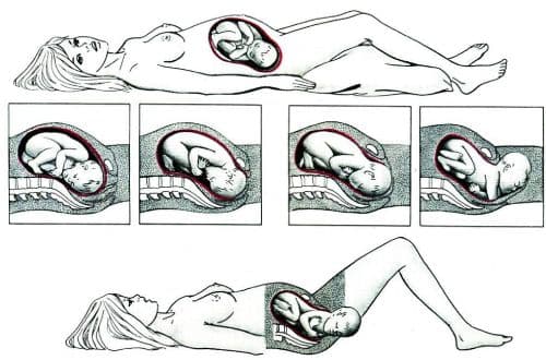 Периоды и фазы в родах