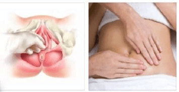 Гинекологический массаж