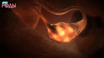 Процедура ЭКО